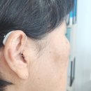 오티콘보청기양평센터