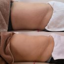 삼일여자고등학교 | 울산 에스테틱 추천 노진희피부연구소 피부관리 다이어트 복부 리프팅 후기