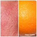 쎌치과의원 | 피부과에서 죽다 살아나다.