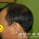 미남가발