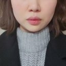 안면윤곽 컷주사 고민하지 마세요