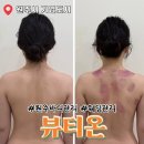 기업도시3로 | 원주기업도시 바디관리 뷰티온에서 등슬리밍 1회차 후기