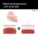 파주경희한의원 네이버블로그