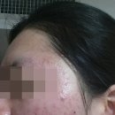 리유한의원 신촌점 직접 다녀본 후기, 가격 공유