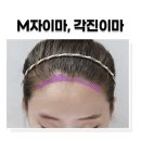 에이치헤어라인 네이버블로그