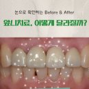 웰치과기공소 이미지