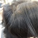 계산삼거리신도브레뉴 | 헤어:: 머리에 비듬 생기는 이유! 계산동 미용실 림스헤어 두피스켈링 후기