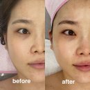 가경동덕일한마음A | 올가드림뷰티 청주가경점 모공디톡스 후기