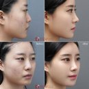 노화장 이미지