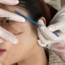 세라헤어라인 이미지