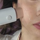 주)아산메디칼 | 청담동피부과에서 덴서티리프팅 시술 후기 효과 통증 비용 알아보아요