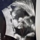 서리풀길 29-4 (1) | 📔 임신일기 29~31주 : 임신 후기 증상, 만삭사진 촬영, 산전 마사지, 아기방 만들기