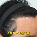 모엠의원 Daum카페