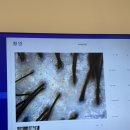 지에스25 소담중흥점 | [기타리뷰]광교 지루성두피는 모디슨광교점에서 해결!광교 두피관리 솔직후기