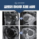 글로리의원 이미지