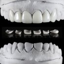 라라치과기공소 이미지