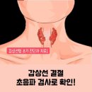 나비편한샘의원 | 남성 갑상선 증상, 대구 나비편한샘의원에서 해결하세요! [남성 갑상선 증상]