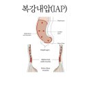 리즈핏 PT 이미지