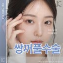 자연 | 광주쌍꺼풀수술 눈성형 쌍수 자연스러운 후기 결과를 고려한다면