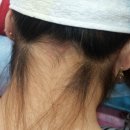 목련헤어라인 이미지