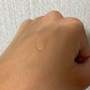 진도중학교 | 리쥬란힐러 시술후기 통증 효과전후 차이 3회 효과시기