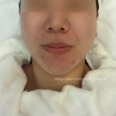 더베스트헤어 | 인계동피부관리 프라이빗 셀럽 케어 미더베스트 수원점 대만족 솔직후기