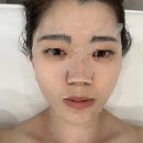 하이필스킨 여의도점 | [뷰티 리뷰] 하이필스킨 여의도피부관리 압출 후기