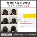 도트인스칼프 이미지