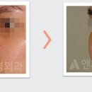 앤써성형외과의원 이미지