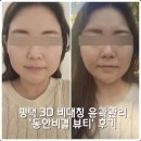 세븐일레븐 평택세교원룸점 | 평택 비대칭 윤곽관리 체형교정 &#39;동안비결뷰티&#39; 후기