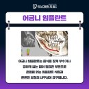동향치과 의원 네이버블로그