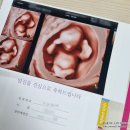인천 송도 산후조리원 퀀즈그로브 직접다녀온 솔직후기