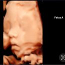 하품 | [임신 28주차] 햇빛병원 쌍둥이 임신후기 입체초음파 후기 :: 하품하는 모습 발견! 쌍태아 위치 역아 횡아