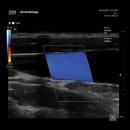 GM메디칼 이미지