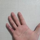 강남스마트신경과의원 | 강남신경과 강남스마트신경과의원 :: 자율신경기능검사 손저림원인 해결