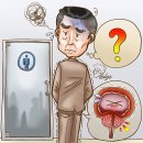 전립선 초음파 검사 Prostate ultrasonography (전립선 MRI) 이미지