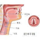 대화이비인후과의원 네이버블로그