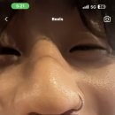 채은스킨케어