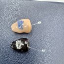 평택보청기 이미지