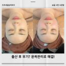 리벨라 뷰티 후기! 산후윤곽관리 받고 달라진 얼굴 라인