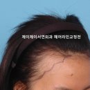 제이제이서연외과의원 네이버블로그