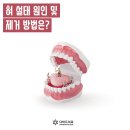 다비드치과 이미지
