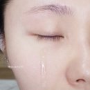 테라피 드 포레