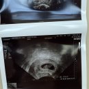 윤은숙산부인과의원 이미지