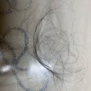 아로마모텔 | 극심한 탈모 극복 후기｜도테라 아로마로 한 달 만에 달라진 변화