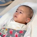 개포서울약국 | 생후 70일 아기 지루성피부염, 외이도염 | 생기는 이유, 처방약, 예방방법