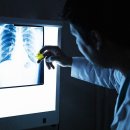흉부 폐질환 식별, 방사선 전문의가 AI 능가… 이미지