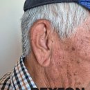 울산독일보청기 | 울산 보청기 후기｜처음 착용하신 아버님, 렉스톤 AMZ1763-DRWC 양이형 보청기로 일상 속 웃음을 되찾다