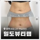 평택여자중학교 | [평택다이어트] 뱃살 허파고리 극초단파 기기관리 &#39;밀도뷰티랩&#39; 솔직후기