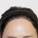 헤인헤어 이미지